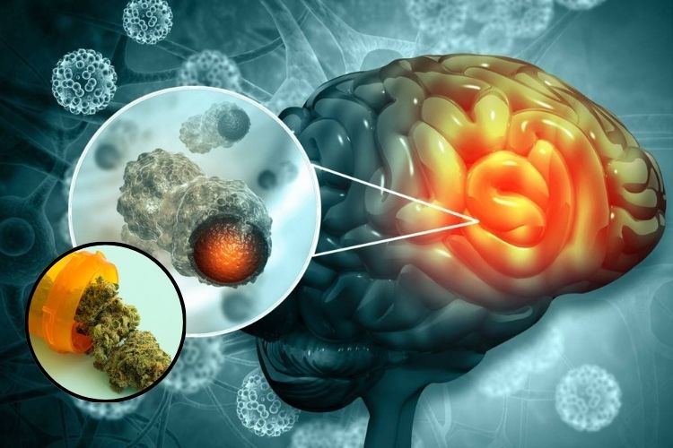 Tesis doctoral de la UNAL, destacó cannabis para el tratamiento del cáncer de cerebro2